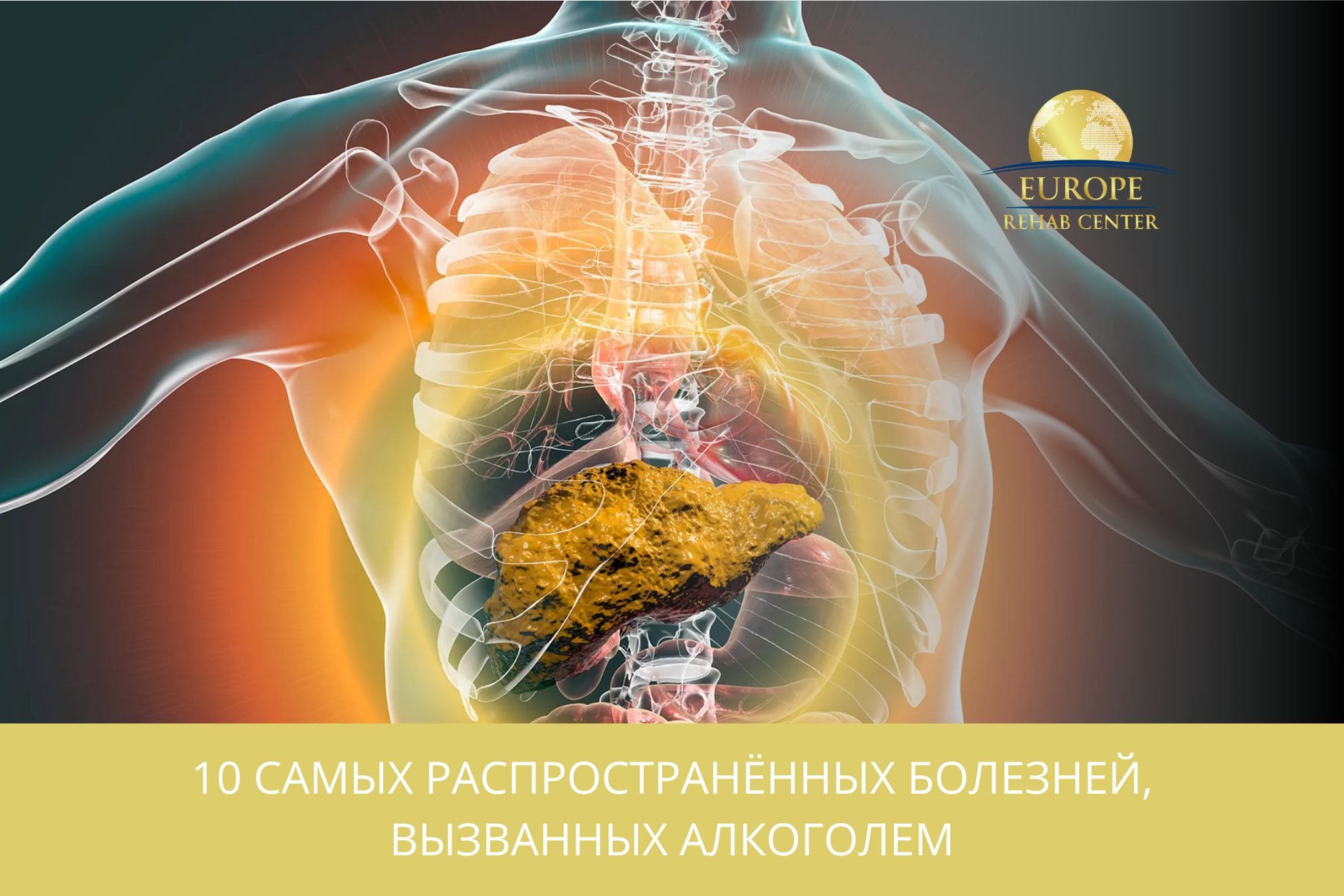 10 самых распространённых болезней, вызванных алкоголем